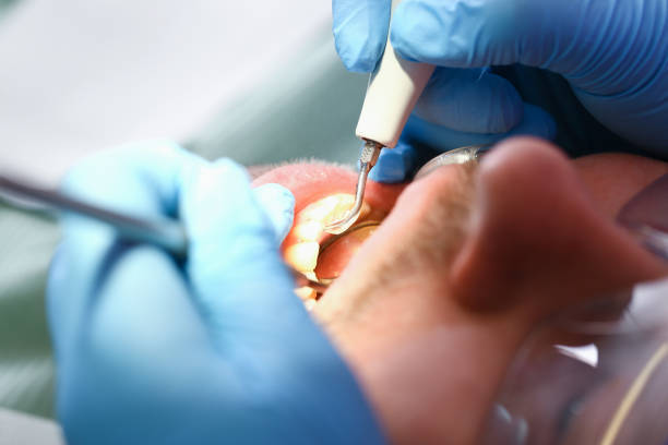 Best Mobile Emergency Dentist in Twentynine Palms, CA