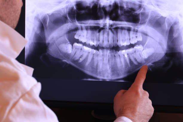 Best Holiday Emergency Dentist in Twentynine Palms, CA