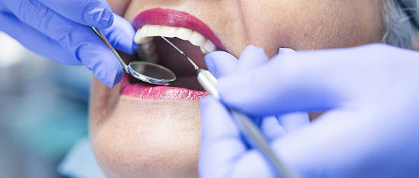 Best Broken or Cracked Tooth Emergency Dentist in Twentynine Palms, CA